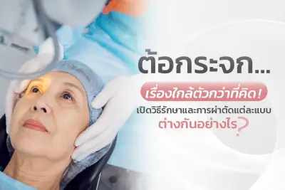 ต้อกระจกเรื่องใกล้ตัวกว่าที่คิด
